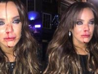 Seksi Oyuncuya Tekmeli Tokatlı Okkalı Dayak!