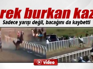 Sadece Yarışı Değil, Bacağını Da Kaybetti