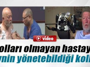 Kolları Olmayan Hastaya Beynin Yönetebileceği Kollar Takıldı